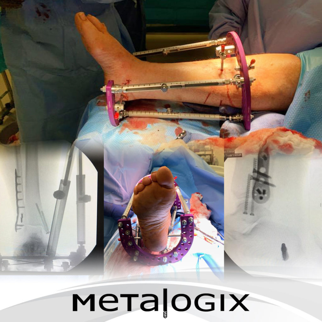 Metalogix news and updates