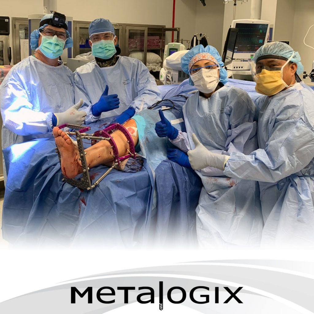 Metalogix ExFx System