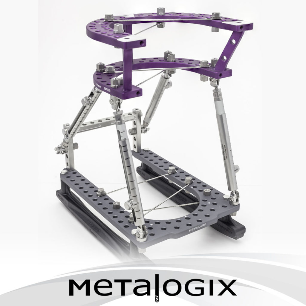 Metalogix Revolution External Fixation System