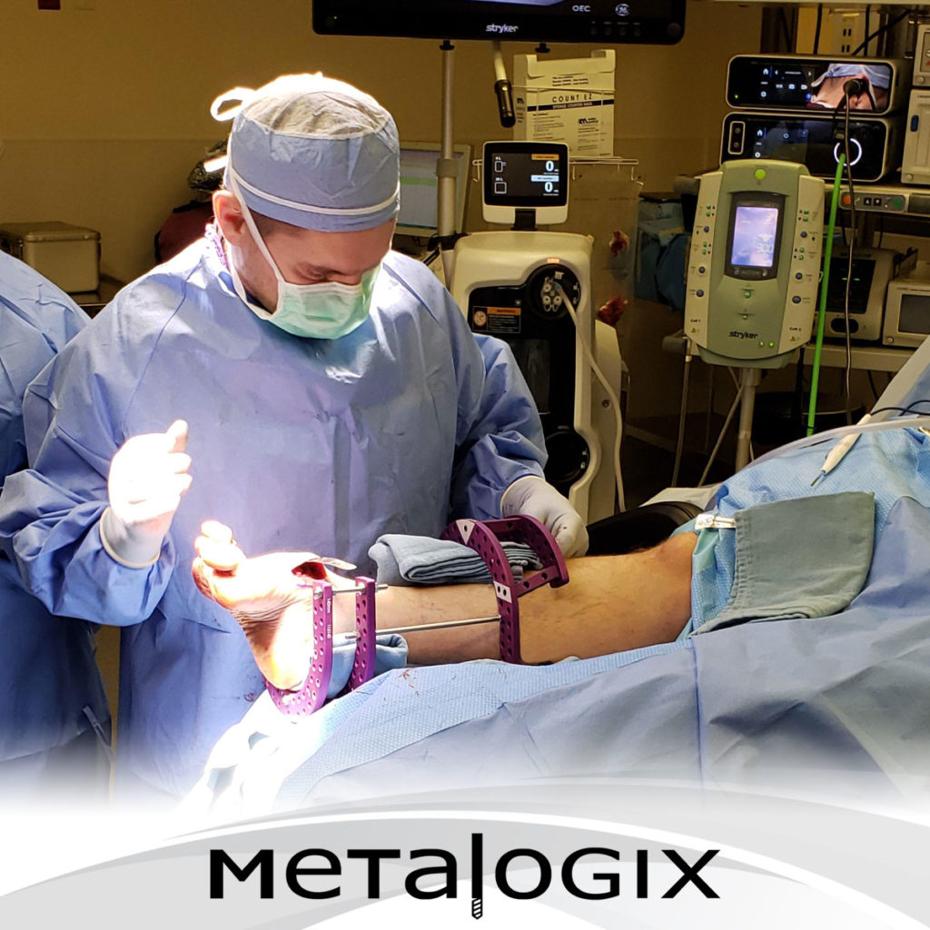 Dr. Dallin Greene using Metalogix Revolution External Fixation System