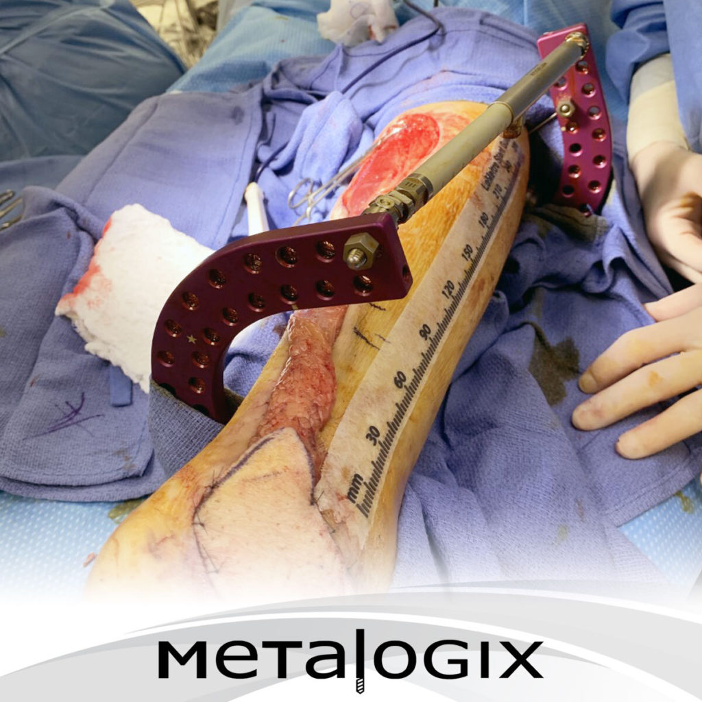 Metalogix Revolution Hlad Flap