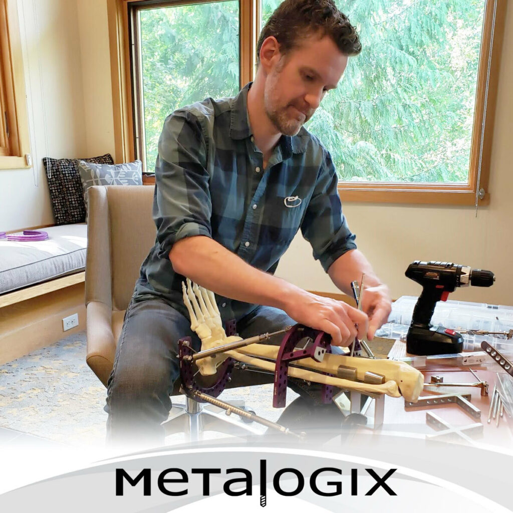 Dr. Craig Clifford uses Metalogix Revolution External Plating System