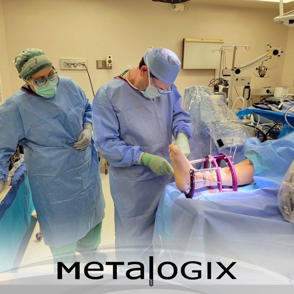 Dr. Bob Olsen uses the Metalogix Revolution External Fixation System